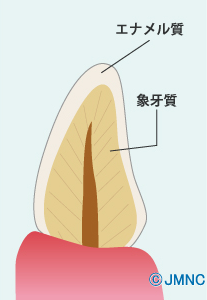 加齢による黄ばみ