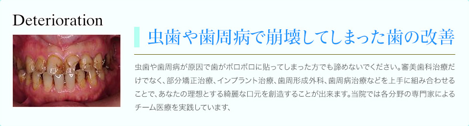 崩壊したお口の総合治療