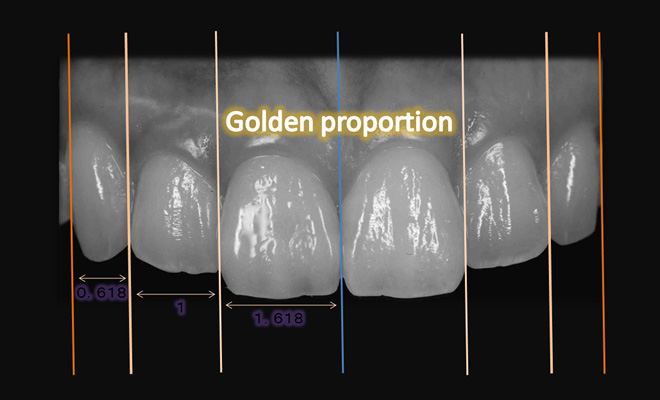 Golden Proportion